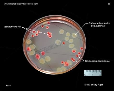 Klebsiella Pneumoniae On Macconkey Agar