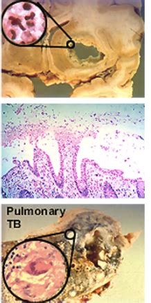 Infectious Disease Flashcards Quizlet