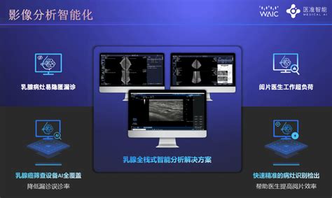 虎嗅·大鲸峰会医准智能为您带来基于“智慧医疗”的三大看点 知乎