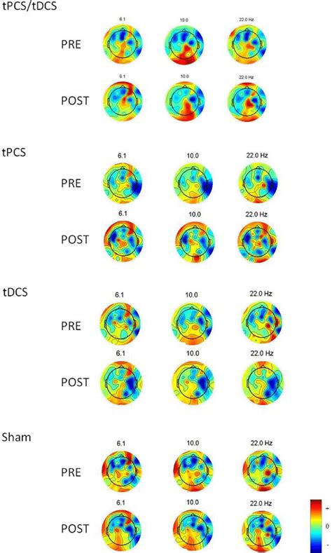 Topoplots Showing The Topographic Distribution Of The Different