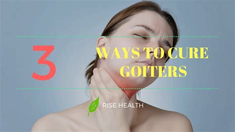 How to Cure Goiters | 3 Ways to Cure Goiters | Rise Health - YouTube