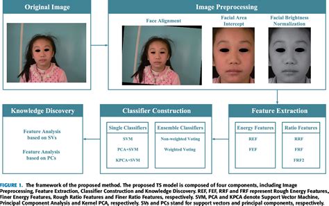 Figure 1 From Diagnosis And Knowledge Discovery Of Turner Syndrome Based On Facial Images Using