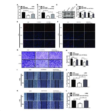 Hotairm1 Facilitated Malignant Transformed Fibroblasts Progression