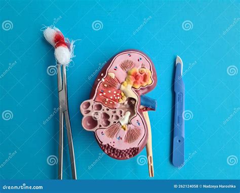 Kidney Transplant Surgery Concept Kidney Removal Closeup Stock Photo ...