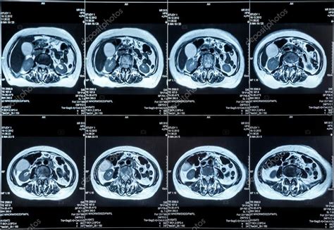 Wat Is Een Mri Scan Mri Scan Nl