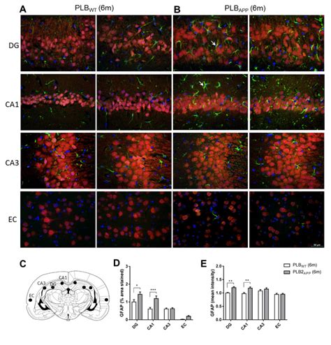 Expression And Quantification Of Gfap Labelled Astrocytes Co Localizing