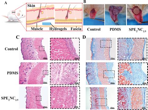 In Vivo Biocompatibility And Anti‐fiber Capsule Evaluation Of Spe2nc25