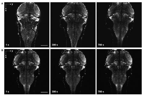 In Vivo Whole Brain Imaging Of Zebrafish Larvae Using Three Dimensional