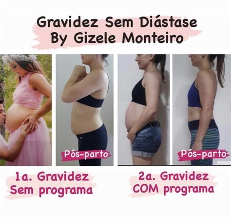 O que fazer para não ter diástase na gravidez Gizele Monteiro Mães