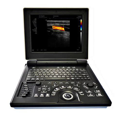 D D D Portable Full Digital Color Doppler Ultrasound Scanner Machine