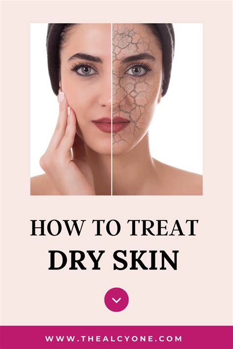 How To Get Rid Of Dry Flaky Skin On Body Artofit