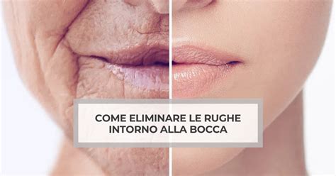 Come Eliminare Le Rughe Intorno Alla Bocca OGMedica Clinica Di