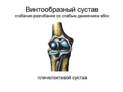 Суставы прерывные соединения или диартрозы Строение сустава