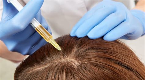 How Long Does It Take For Platelet Rich Plasma Hair Therapy To Work