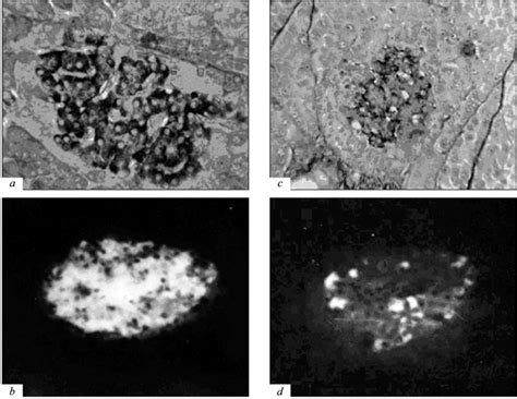 Cysteine Effects On Rabbit Pancreatic β Cells Aldehyde Fuchsin