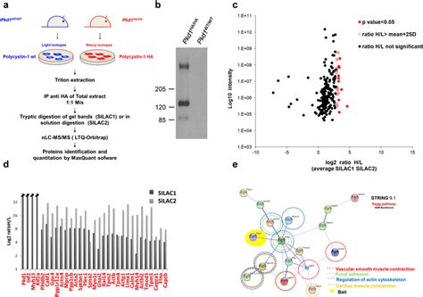 Polycystin Interactome Study A Proteomic Workflow Of The Silac