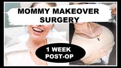 Mommy Makeover Surgery Experience 1 Week Post Op Tummy Tuck