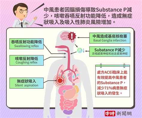 中風一年再住院率竟有五成！「吸入性肺炎」是失能殺手 中風後活出健康自在 別讓嗆咳上身的關鍵 東生華製藥