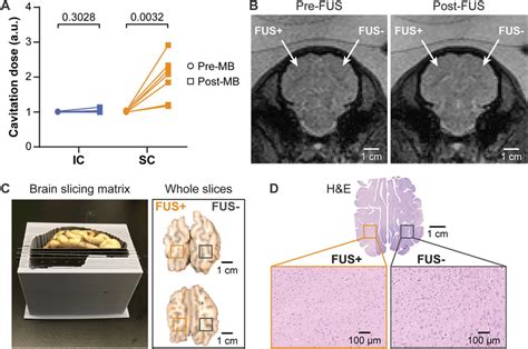 Safety Assessment Of Fus Lbx A Calculated Cavitation Levels For Each