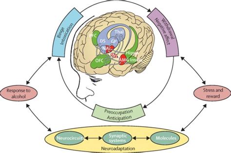 What Is The Medical Model Of Addiction