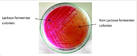 Macconkey Agar Salmonella