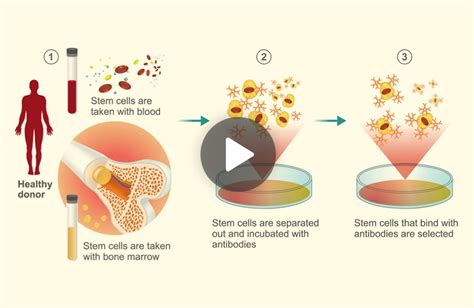 Difference Between Cord Blood And Cord Tissue Stem Cells Healthcord