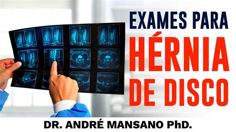 Principais Exames Para H Rnia De Disco Dr Andr Mansano Tratamento