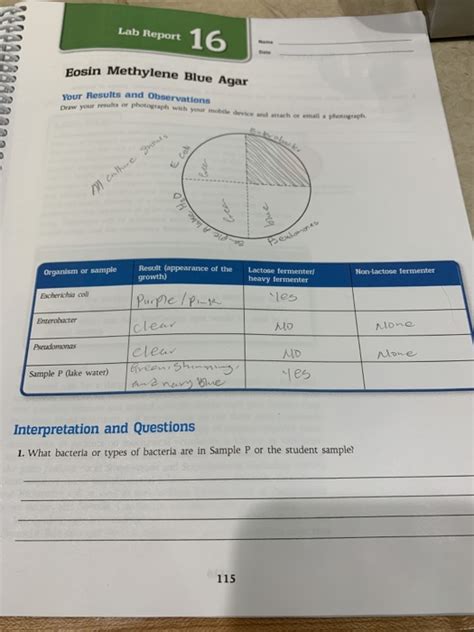 Solved Lab Report 16 Eosin Methylene Blue Agar Results and | Chegg.com