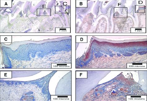 Sdf 1a Expression In P Gingivalis Lps Induced Periodontal Bone Loss