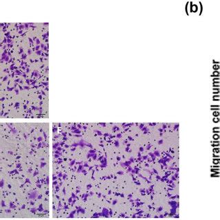 Cell Invasion Assay Results A A Blank Control Group B Gv