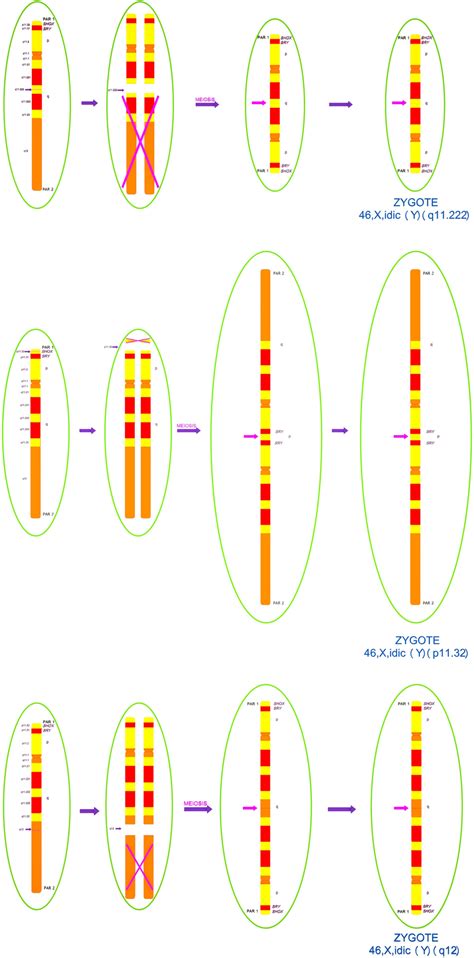 A Representation Of 46xidicyq11222 Case 12 Breakpoint Region By Download Scientific