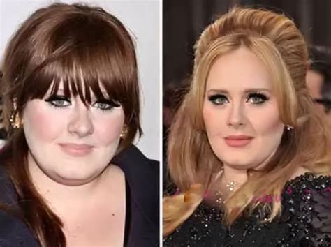 Adele Before After Plastic Surgery