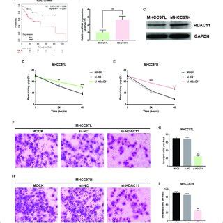 Knockdown Of Hdac Suppressed Metastasis Of Hcc In Vitro A High