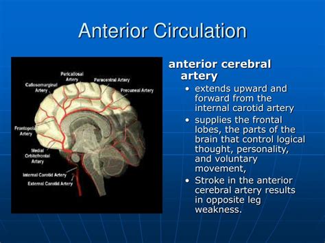 Ppt Cvd Stroke Septemius A Pansacola Rnmd Powerpoint Presentation