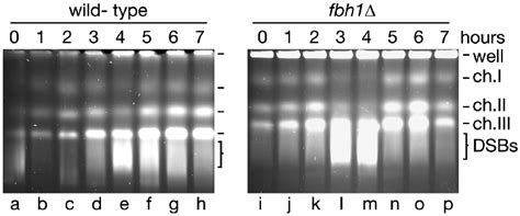 Pulse Field Gel Electrophoresis Analysis Of Chromosomal Dna From A