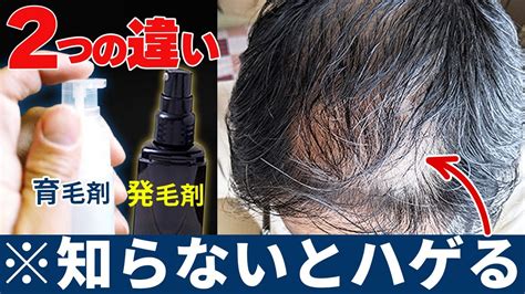 【意外と知らない】育毛剤と発毛剤の違いとは？分かりやすく解説します Youtube