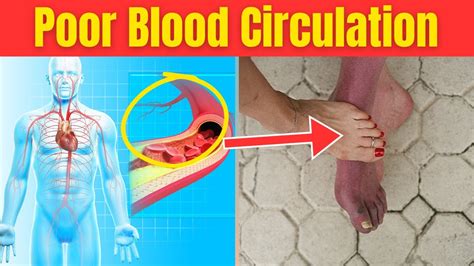 10 Warning Signs Of Poor Blood Circulation That Often Go Ignored YouTube