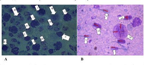 Figure 2 From Testicular Cytological Profiles Of Apparently Healthy