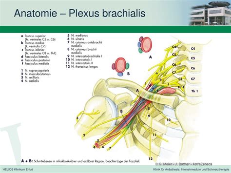 PPT Anästhesie des Plexus brachialis LSIP PowerPoint Presentation