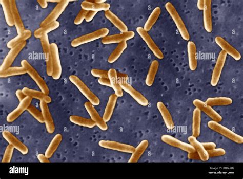Morganella Morganii Gram Stain
