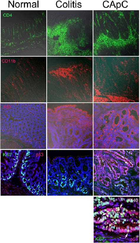 Immunofluorescence Analysis Of Cd Cd B Aid Ki And P