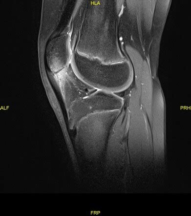 Playlist Knee 1 By DR Mohamed Shweel