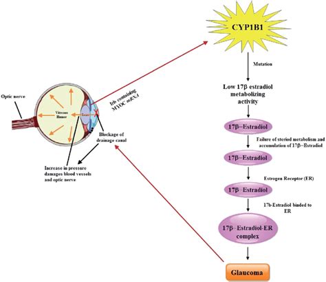 Glaucoma Pathophysiology Flow Chart Astigmatism Glaucoma Swollen Eyes