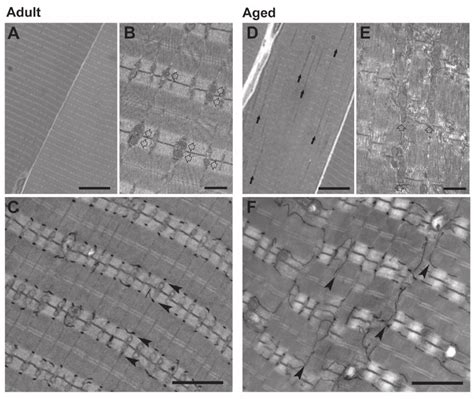 Analyses Of Adult And Aged Edl Muscle By Light And Electron Microscopy