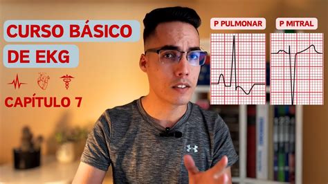 Crecimiento Auricular Electrocardiograma YouTube