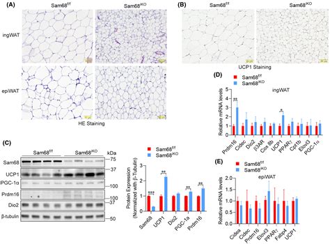 Ablation Of Sam68 In Adult Mice Increases Thermogenesis And Energy