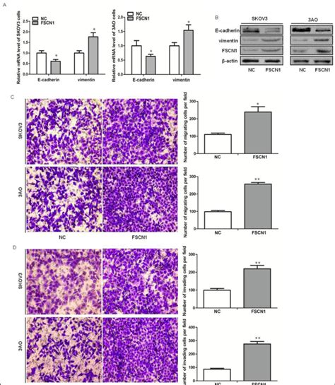 Overexpression Of Fscn1 Promoted Emt In Ovarian Cancer Cells A