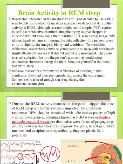 Brain Activity In Rem Sleep Sleep Disorders Sleep Apnea Periodic Limb