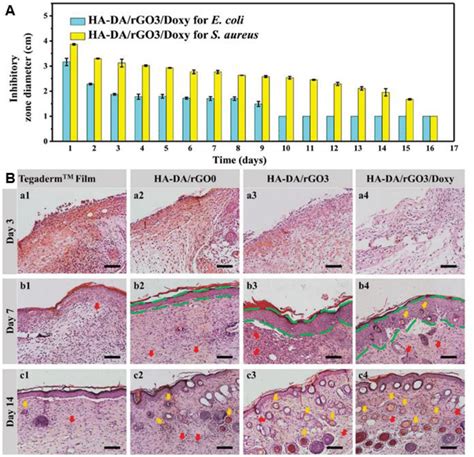 A Inhibitor Zones From Sterilizing Effectiveness Test Against E