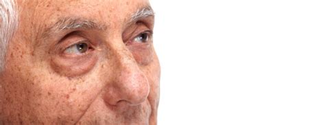 Blefaroconjuntivitis Causas Síntomas Y Tratamiento Blog De Clínica